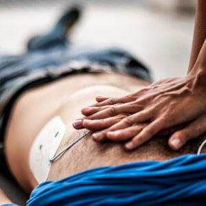 AED being used while performing CPR